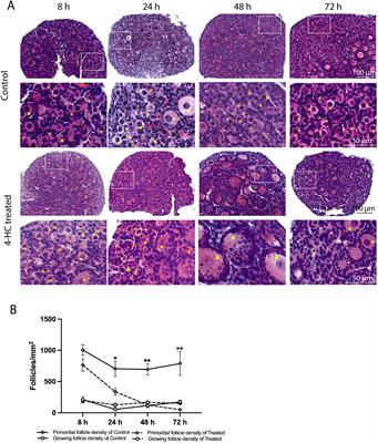 Evidence of apoptosis as an early event leading to cyclophosphamide-induced primordial follicle depletion in a prepubertal mouse model